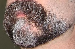 barba-flickr-fuzzyjay barba cresce flickr fuzzyjay