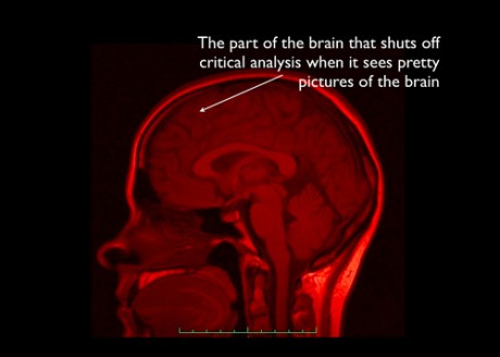 cerebro que é enganado pelo cérebro
